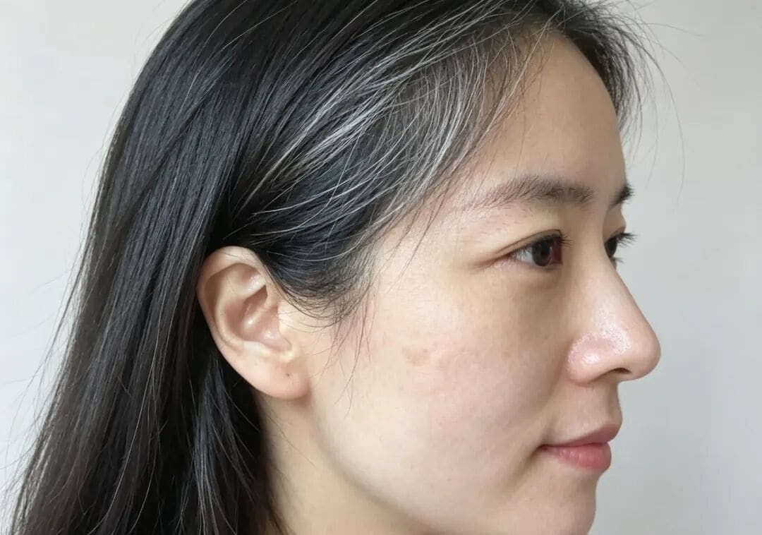 30岁后白发突然变多?很多人忽略了背后的真正原因 30岁后白发突然变多?很多人忽略了背后的真正原因