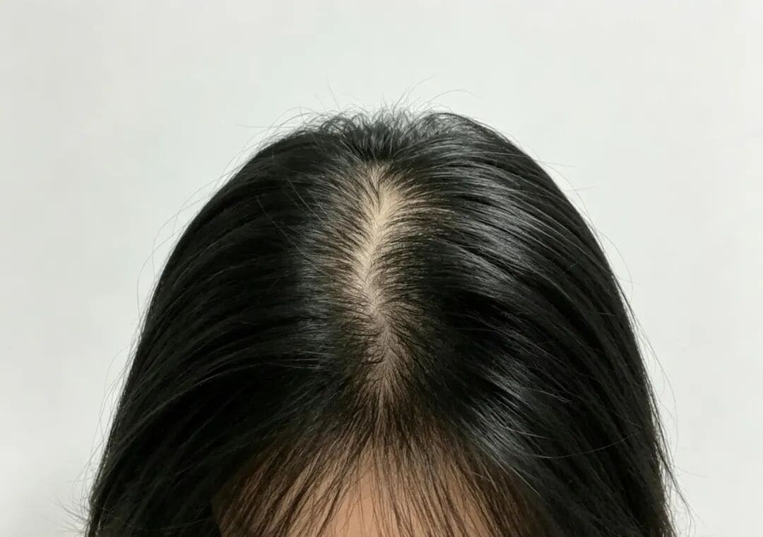 合生和做养发之前,为什么要先做头皮检测?一分钟告诉你答案 合生和做养发之前,为什么要先做头皮检测?一分钟告诉你答案